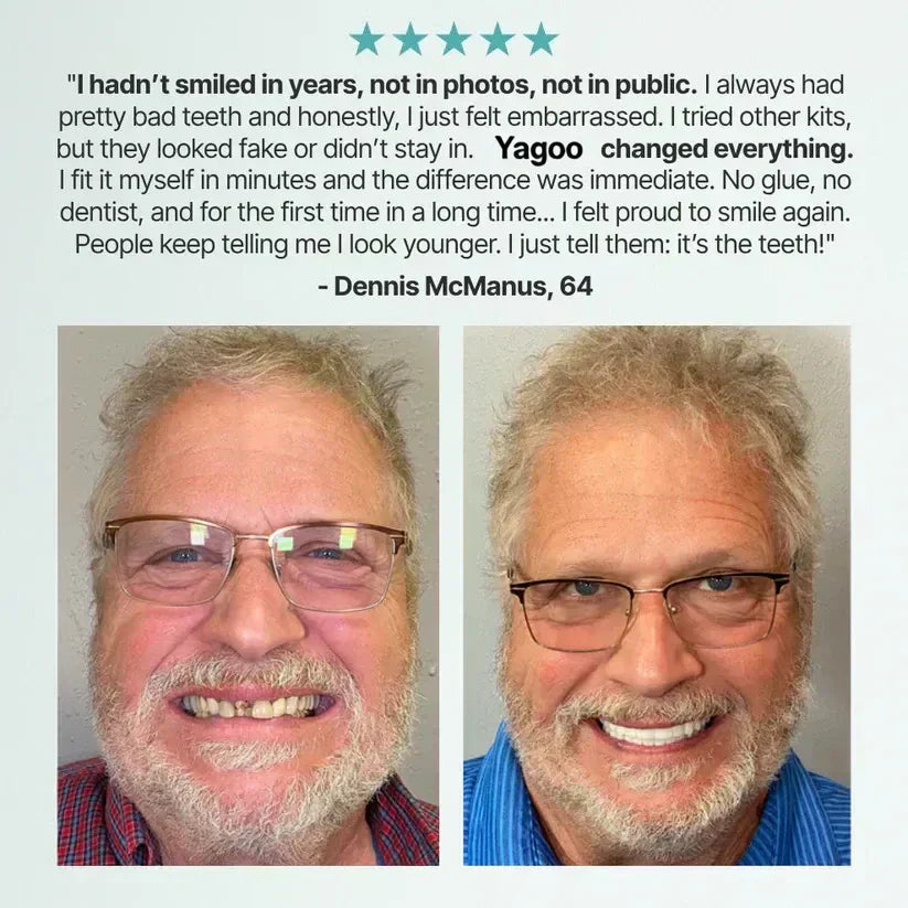 🌎Ends Today: 60% OFF! ⏰ Medical Full Denture with Strong Suctiond🦷Obtain American Dental Association (ADA) Certification