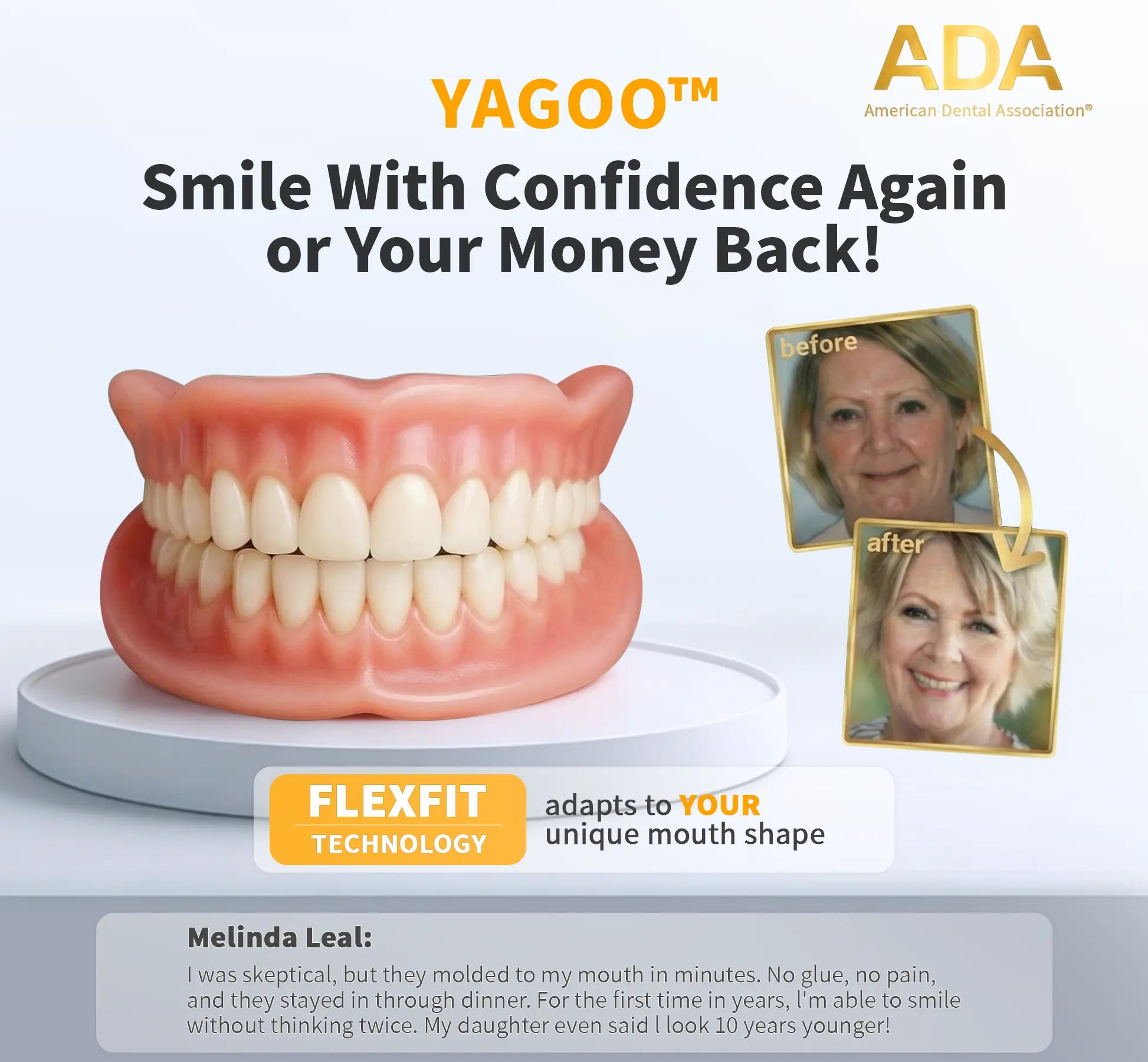 YAGOOTM Custom-Fit Full Functional Dentures