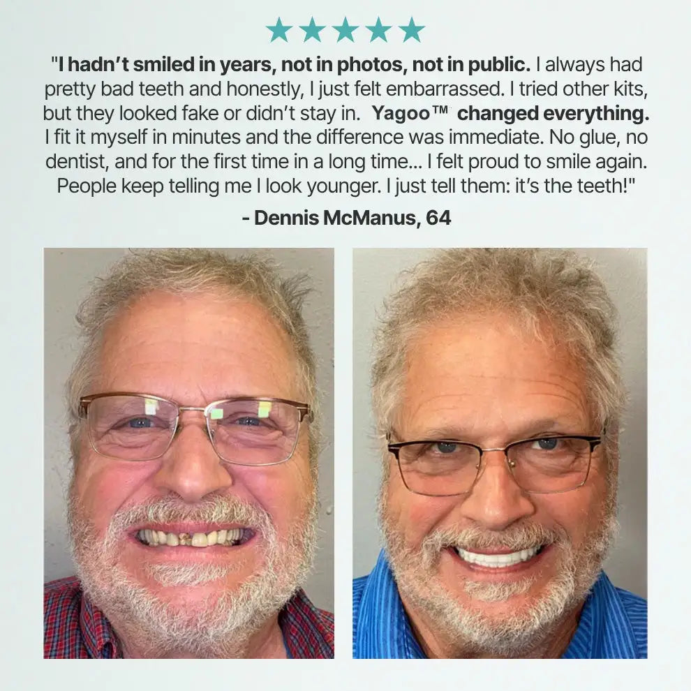 YAGOOTM Custom-Fit Full Functional Dentures