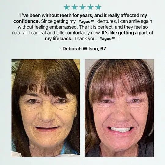 YAGOOTM Custom-Fit Full Functional Dentures